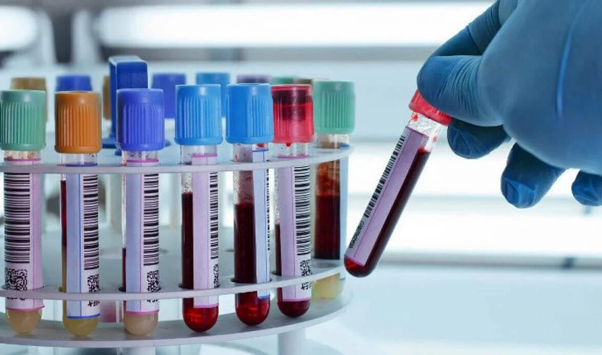 تست آزمایش خون